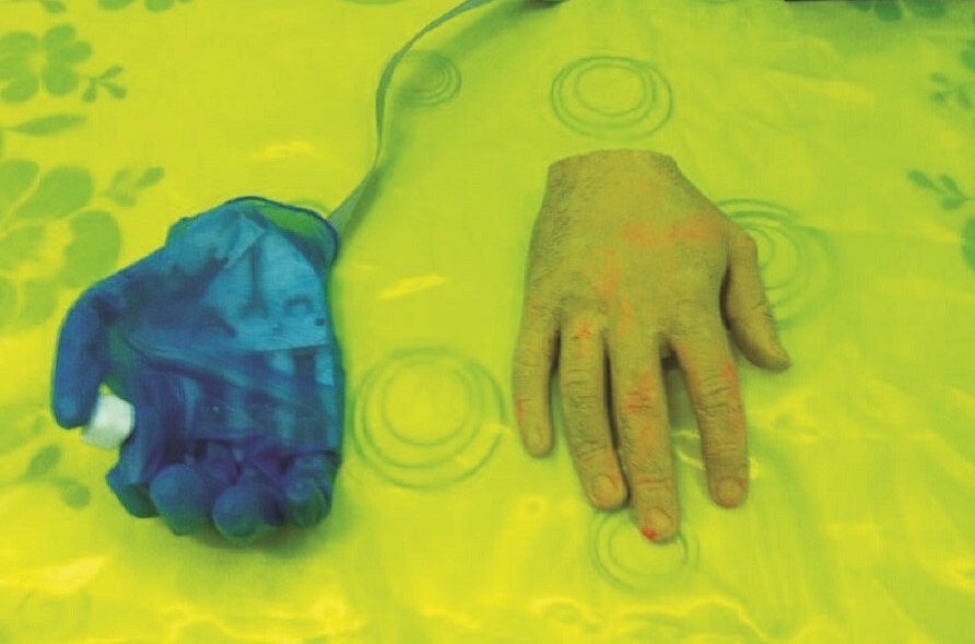 دست مصنوعیبا دست خالی