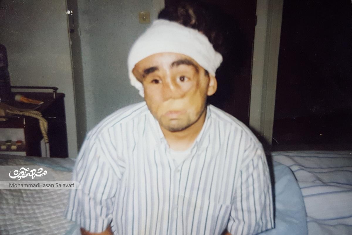 چهره حسن عمرانی صد بار زیر تیغ جراحی رفته است چهره حسن عمرانی صد بار زیر تیغ جراحی رفته است