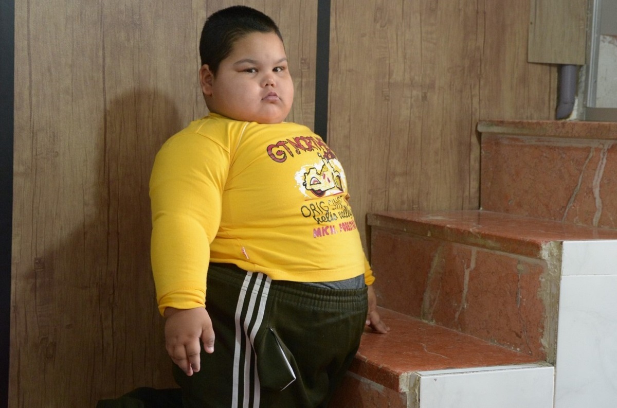 وزن زیاد قدرت راه رفتن را از مهدیار ۴ ساله گرفته است